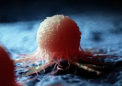 新的联系揭示了癌症如何逃避免疫系统
