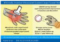 微创超声引导腕管松解术可改善长期结果