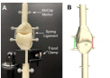 计算模型可以改善膝关节植入物的对准