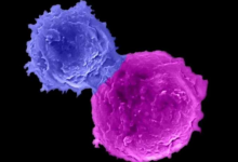 研究解释了改造免疫细胞的新方法可以治疗多种癌症患者