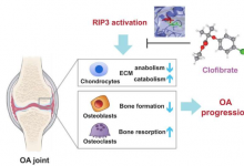 靶向 RIP3 可通过恢复骨软骨单元中的合成代谢-分解代谢平衡来抑制骨关节炎的发展