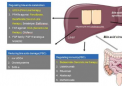 胆汁淤积性肝病患者管理的进展