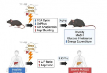 新研究探讨尿素循环与脂肪肝疾病的密切联系