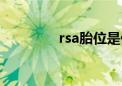 rsa胎位是什么意思（rsa）