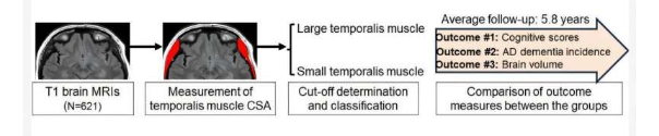 研究发现肌肉损失可能会增加痴呆症的风险